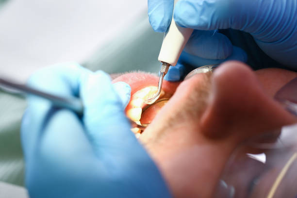 Best Walk-In Emergency Dental Services in Binghamton, NY